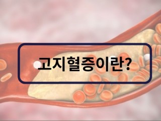 고지혈증, 유산소운동을 많이 해야