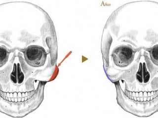 또다른 매력포인트 "광대뼈"