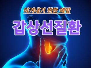 갑상선질환 증상 및 치료법
