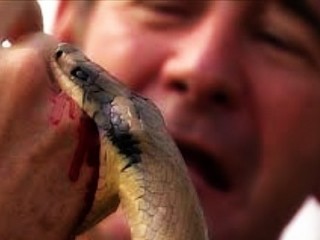 뱀에 물렸을 때