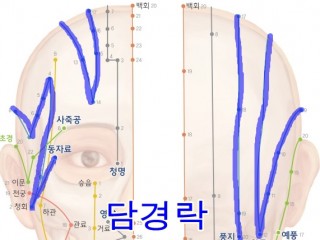 편두통이 심할 때