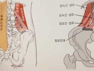 허리를 다쳤을때