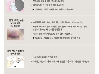 눈을 다쳤을때