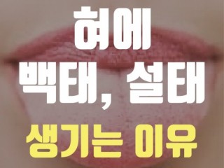 설태는 몸속 질병 비춰주는 거울