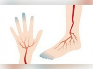 냉증 - 궐냉환이 특효