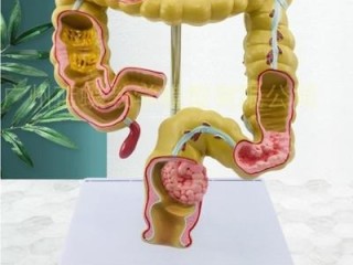 소화기 - 음식물의 하루 여행길