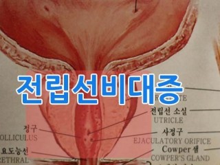 전립선비대증, 산딸기 알약으로 배뇨장애 치료