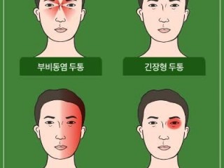 두통 - 진통제만 사먹다 "큰 병" 키울수도...