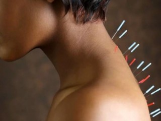 디스크와 침 치료