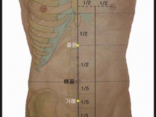 치매증상 - 배꼽아래 뜸 효과