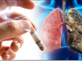 폐(3) - '최종 수문장' 폐 담배연기는 못막는다