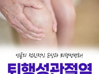 속터지는 "무릎고통", 55세 이상의 80%가 퇴행성 관절염