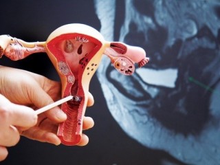 질분비물이 줄어들 때