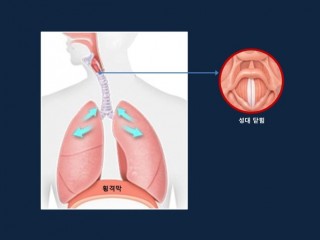'딸꾹질' - 감꼭지, 생강 달여 마시면 효과