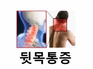 목이 뻐근할 때