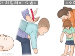 떡, 젤리 등으로 인한 기도폐쇄, 살릴 수 있는 방법